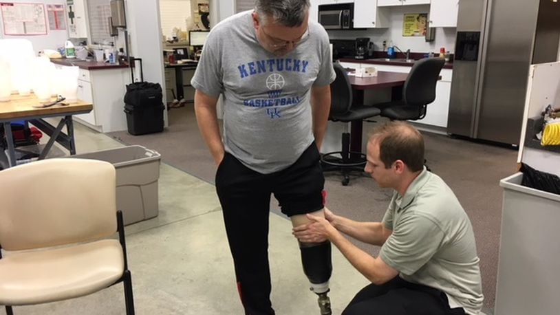 Michael Mullins, 50, a Harrison Twp. resident and patient of Dayton Artificial Limb, works with prosthetist Brad Poziembo on a limb adjustment. Mullins said his new lower leg has changed his life for the better. THOMAS GNAU/STAFF