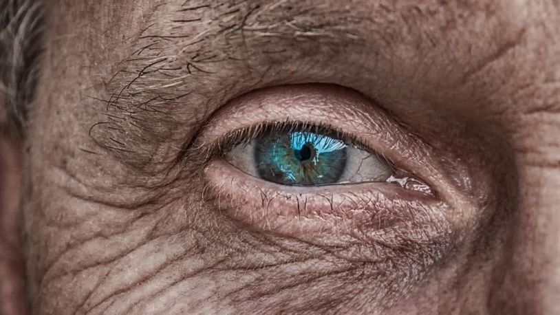 People on metformin, a common diabetes medicine, had a significantly lower risk of developing age-related macular degeneration, researchers discovered in a new study. In fact, half as many patients in the metformin group had the eye condition compared to the control group.