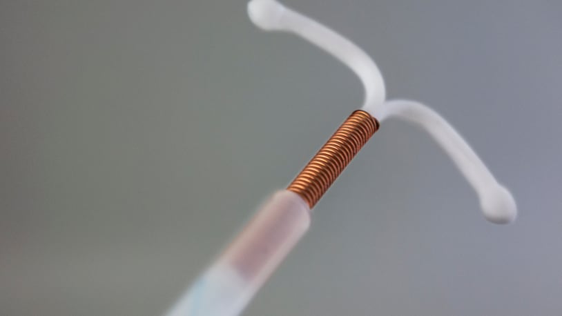 File photo of a copper intrauterine device.