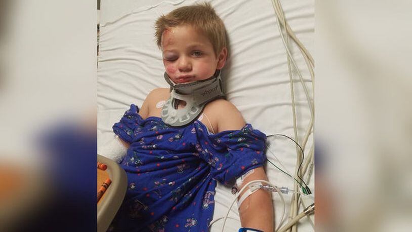 Kross Bentley is hospitalized after being hit by a van while trick-or-treating with his family. His mother was also injured.